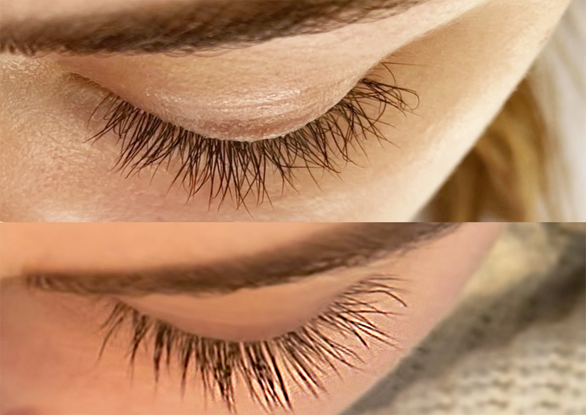 Eyelash growth deals